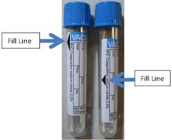 Order test, go to lab, see results! Ptt 50 50 Mixing Study University Of Vermont Medical Center Laboratory Test Catalog