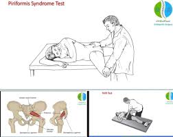 Image result for Pelvic Compression Test