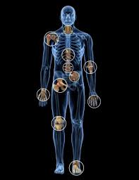 Image result for Pain Disorder