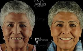Robles Dental