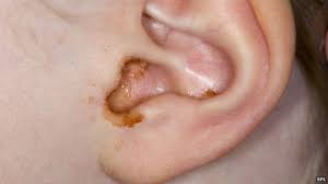 And a few drops of water may be all you need to get rid of a blockage. Secretion Secrets Things You Didn T Know About Ear Wax Bbc News