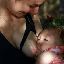 Rash, hives, eczema, sore bottom, dry skin; 6 Tips To Start Your Dairy Free Breastfeeding Journey