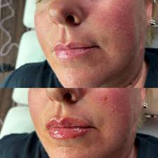 The Beauty Lounge Med Spa