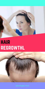 The authors of some studies of avodart that i have read conclude that it can stop further balding, but obviosly it cant grow back a full head of hair. Avodart Hair Loss Results Check This Useful Article By Going To The Link At The Image Hairlosstreat Hair Loss Solutions Help Hair Loss Hair Loss Remedies