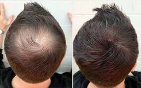 Apart from this ingredient, natural minerals are used as colorants. Caboki Hair Building Fibers 30g