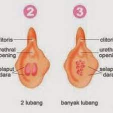 Tentu saja kita menyadari bahwa mengabaikan mereka tidak akan memb. 5 Hal Tentang Selaput Dara Wanita Perlu Tahu Health Liputan6 Com