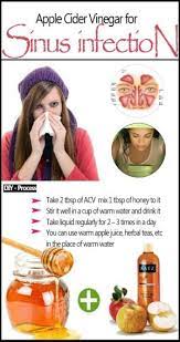 Sinus Infection Home Remedy To Their Sinus Infections This Acv Steam Home Remedy Really Seemed To Health Remedies Health Apple Cider Vinegar Remedies