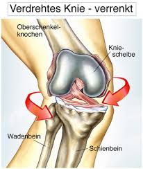 Knieschmerzen Was Tun Gelenk Klinik De