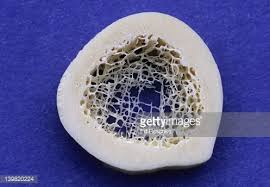 Compact Spongy Bone Cross Section Of A Long Bone Shows Compact Cancellous Bone Bones Cross Section
