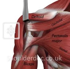 Schematic representation of the right shoulder. Pectoralis Major Transfer Shoulderdoc