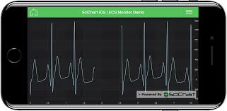 Ios Ecg Monitor Demo Fast Native Chart Controls For Wpf