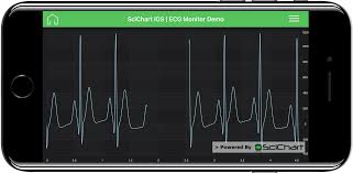 ios ecg monitor demo fast native chart controls for wpf