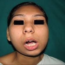 Siddharth Karanth's research works