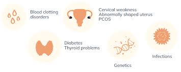 Image result for Recurrent Miscarriage