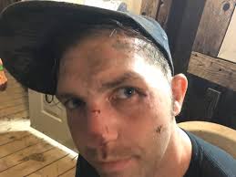 Was anyone concerned about the guy at the GA show?