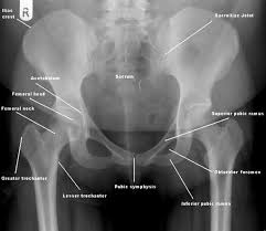 Pelvic skeleton includes two hip bones, sacrum and coccyx. Emergency Radiography The Bmj