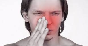 Beberapa cara mengatasi hidung tersumbat pada bayi bisa dilakukan tanpa obat. Petua Meredakan Sakit Resdung Cara Merawat Hidung Tersumbat