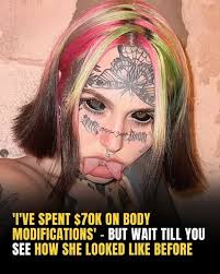 Plastic Surgery and Self-Esteem