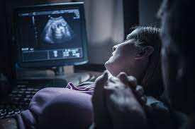 The dating scan usually takes about 20 minutes. 12 Week Pregnancy Dating Scan What Will It Tell Me Madeformums