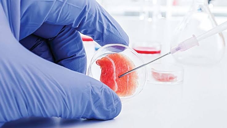 Stem cell therapies breaking barriers | The Guardian Nigeria News - Nigeria  and World News