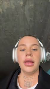 Vad sker???? Jag har full förstålse för lite finnar när man byter märke!  men snälla??? Aldrig haft så här illa hela mitt liv😭och nej det kan inte  vara något annat, har endast använt produkter av dom ...