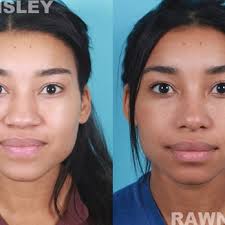 JEFFREY RAWNSLEY, MD