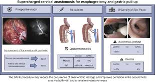 Esophageal cancer rates have been on the rise for the past 3 decades, and esophageal cancer is currently the eighth most common malignancy in the world (1). Supercharged Cervical Anastomosis For Esophagectomy And Gastric Pull Up The Journal Of Thoracic And Cardiovascular Surgery