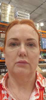 How effective is gabapentin for treating fibromyalgia?