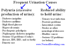 Frequent Urination Causes Chart Diabetes Insipidus