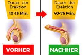 Willkommen auf rezepfrei online der online potenzmittel apotheke. Potenzmittel Kaufen Focus De