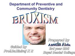 By : Taylor Lawrence Temporomandibular Joint Dysnfunction aka: TMJ Tetanus  Lock Jaw.