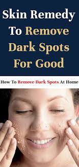 How To Lighten Dark Spots Lighten Dark Spots Beauty Skin Care Dark Spots