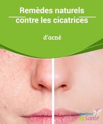Epingle Sur Astuce Beaute