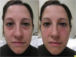 Dr. Jose Luis Rocafort...