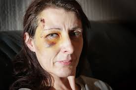 Hit-and-run mum lay for 20 minutes