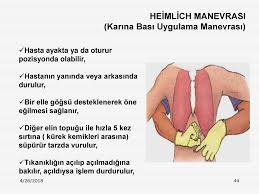 Kuvvetli bir şekilde yukarı yönde ve arkaya çekecek şekilde 5 defa bası uygulanır. Temel Yasam Destegi Bir Onceki Sunumlar Daha Ayrintili 11 Ppt Indir