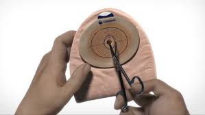 After some practice, changing your pouch will get easier. Changing Your Colostomy Bag