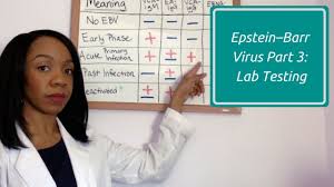 Epstein Barr Virus Part 3 Lab Testing
