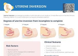 Image result for Uterine Inversion