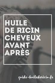 Huile De Ricin Cheveux Avant Apres Cas D Application Huile De Ricin Huile De Ricin Cheveux Cheveux Avant Apres Huile De Ricin