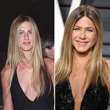 The laser vaporizes skin cells one layer at a time, and the recovery time is 1 to 2 weeks. Jennifer Aniston Looks Exactly The Same 17 Years Later How It Cost Her 1 5 Million Jennifer Aniston Laser Facial Jennifer Aniston Pictures