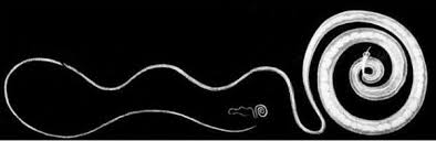 Image result for Whipworm