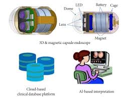 Image result for Wireless Capsule Endoscopy