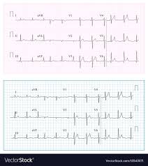 heart cardiogram chart set healthy heart