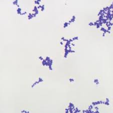 A report showing gram positive cocci appearing in clusters has an indication that after a culture test, staphylococcus species of bacteria will be identified. Gram Positive Coccus Slide W M Gram Stain Carolina Com