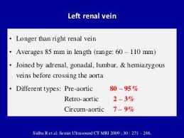 Doppler Ultrasound Of The Kidneys In 2020 Ultrasound Renal Vein Thrombosis
