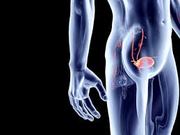 What are the symptoms of bladder cancer? What Is The First Sign Of Bladder Cancer United Hospital Center Urology