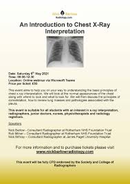 Image result for Chest XRay Interpretation