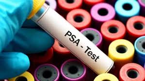 The earlier the detection of prostate cancer, the better the patient's chance of survival is. Prostate Cancer 6 Warning Signs That Men Should Not Miss Health Hindustan Times