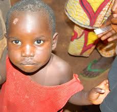 Medical Mission Beginnings